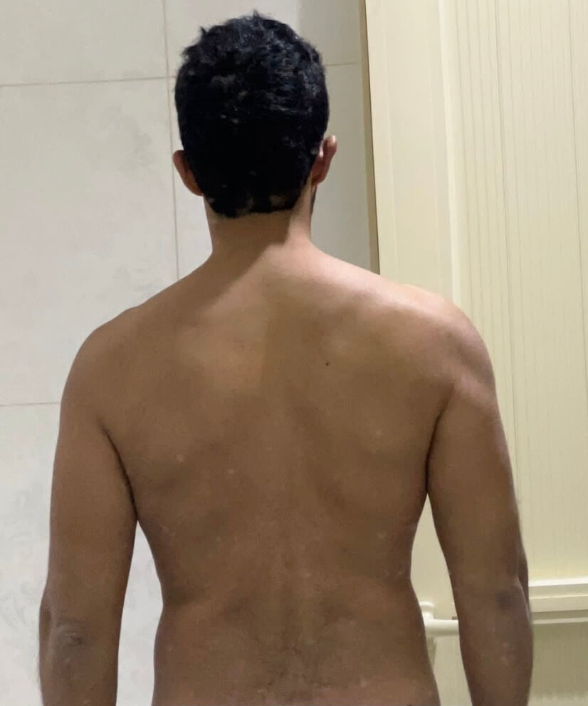 قبل - التحول 1