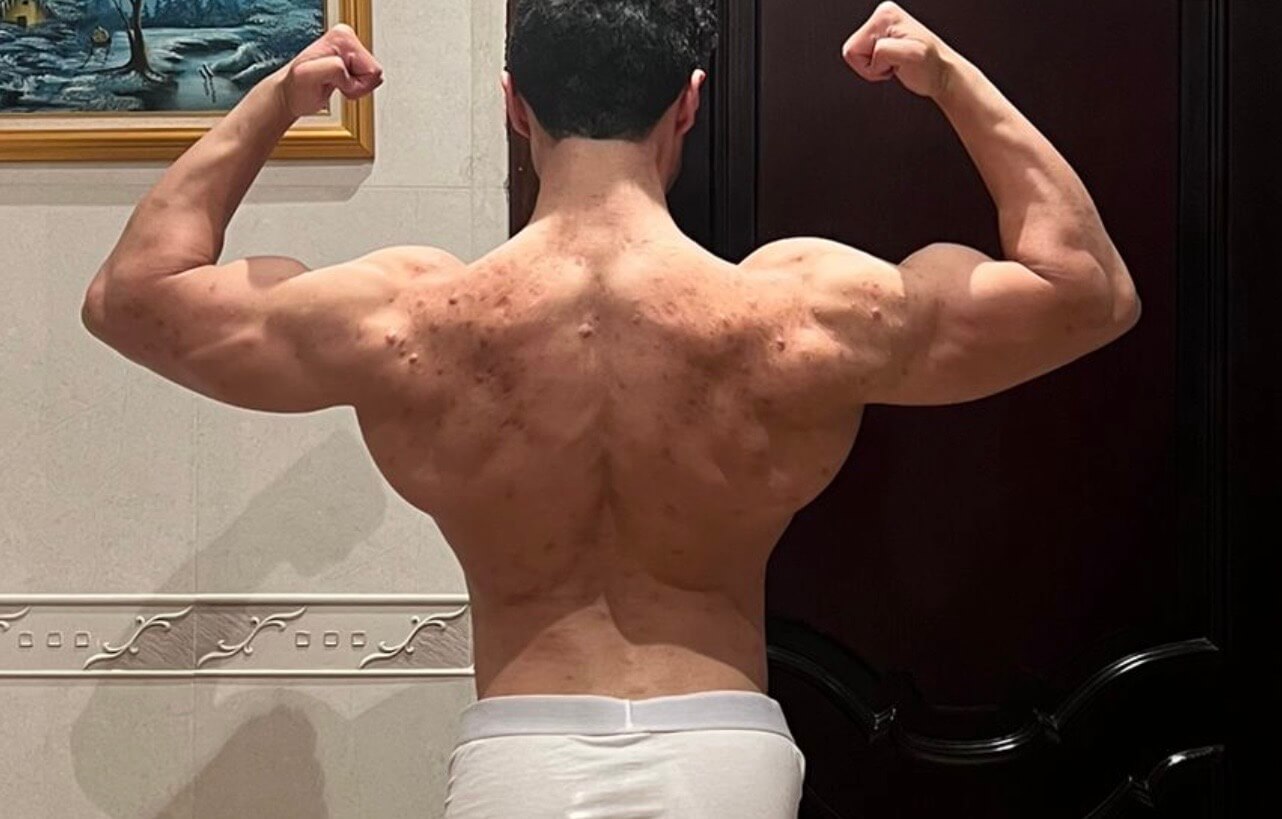 بعد - التحول 15